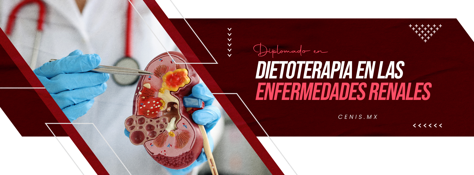 DIETOTERAPIA EN ENFERMEDADES RENALES